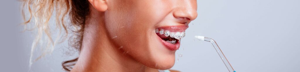 6 Best Water Flossers to Keep Your Teeth and Braces Clean – Reviews and Buying Guide
