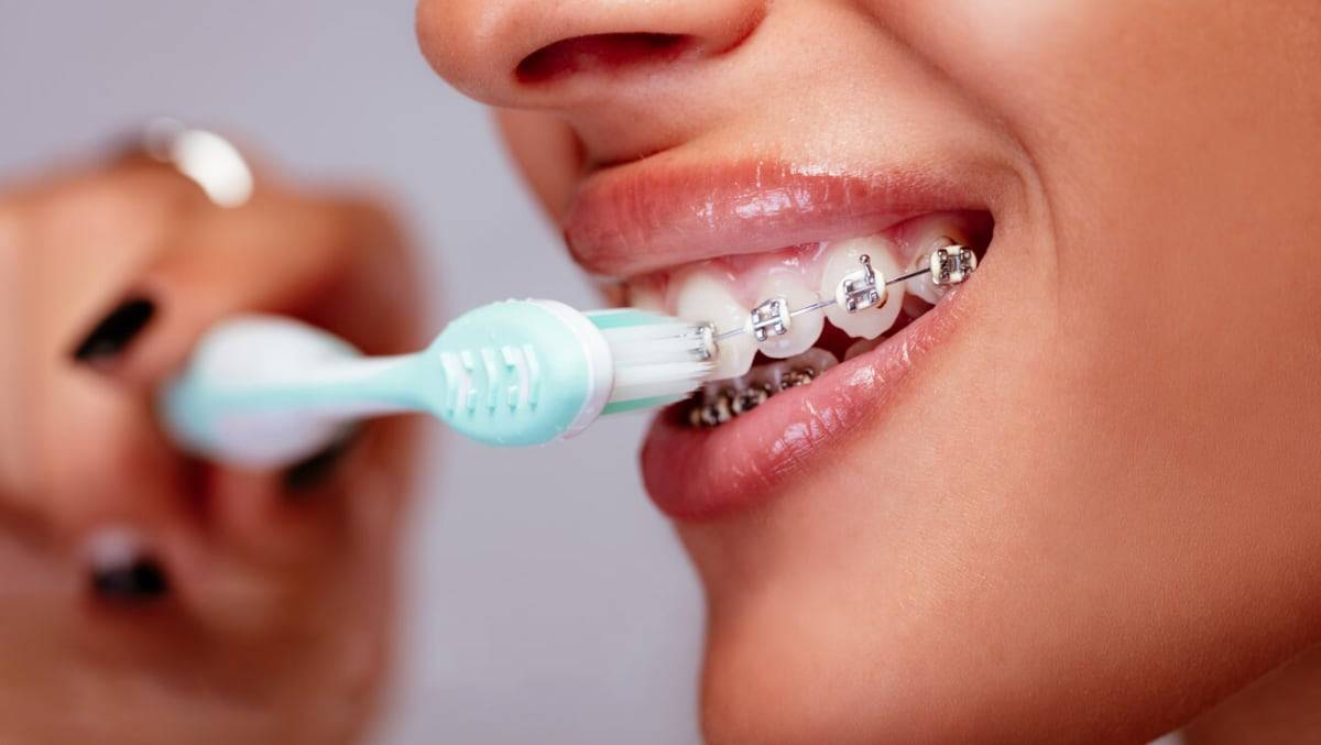 6 Best Electric Toothbrushes for Braces (Spring 2024) Reviews & Guide